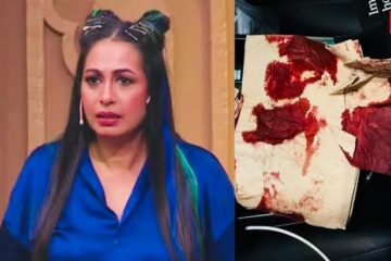 Krushna Abhishek says about the bizarre accident that happened to Kashmera Shah at a mall in the US: ‘She has injuries on her face, she is undergoing treatment’