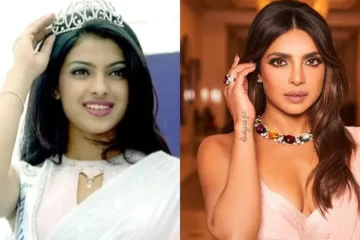 Priyanka Chopra’s Father Stood by Her After Botched Nose Surgery