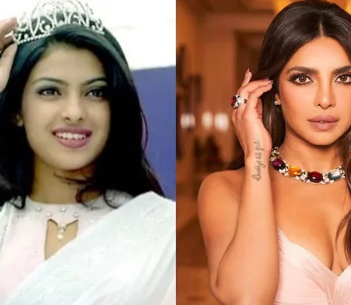 Priyanka Chopra’s Father Stood by Her After Botched Nose Surgery